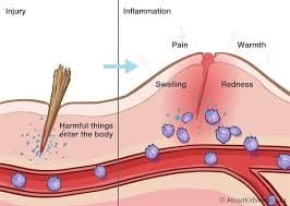 Fighting Inflammation